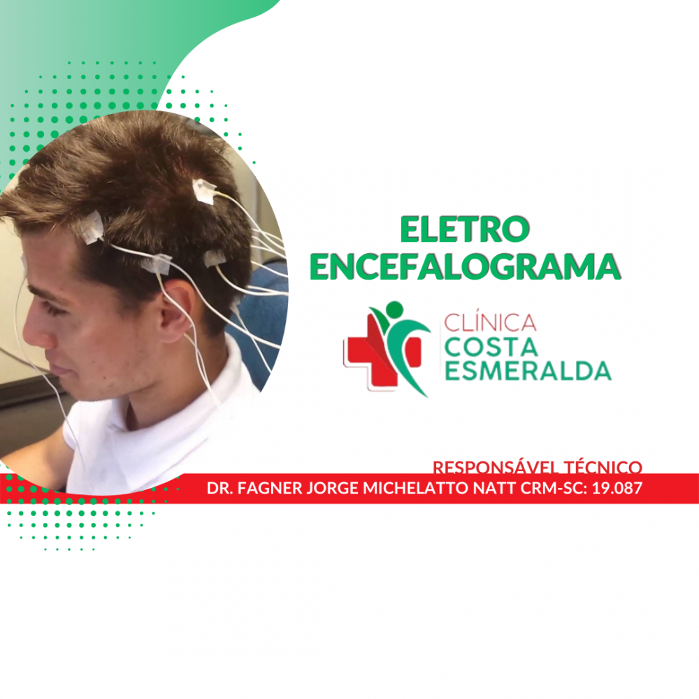 ELETROENCEFALOGRAMA